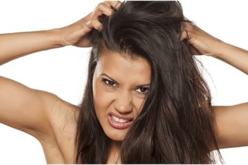 itchy and dandruff scalp